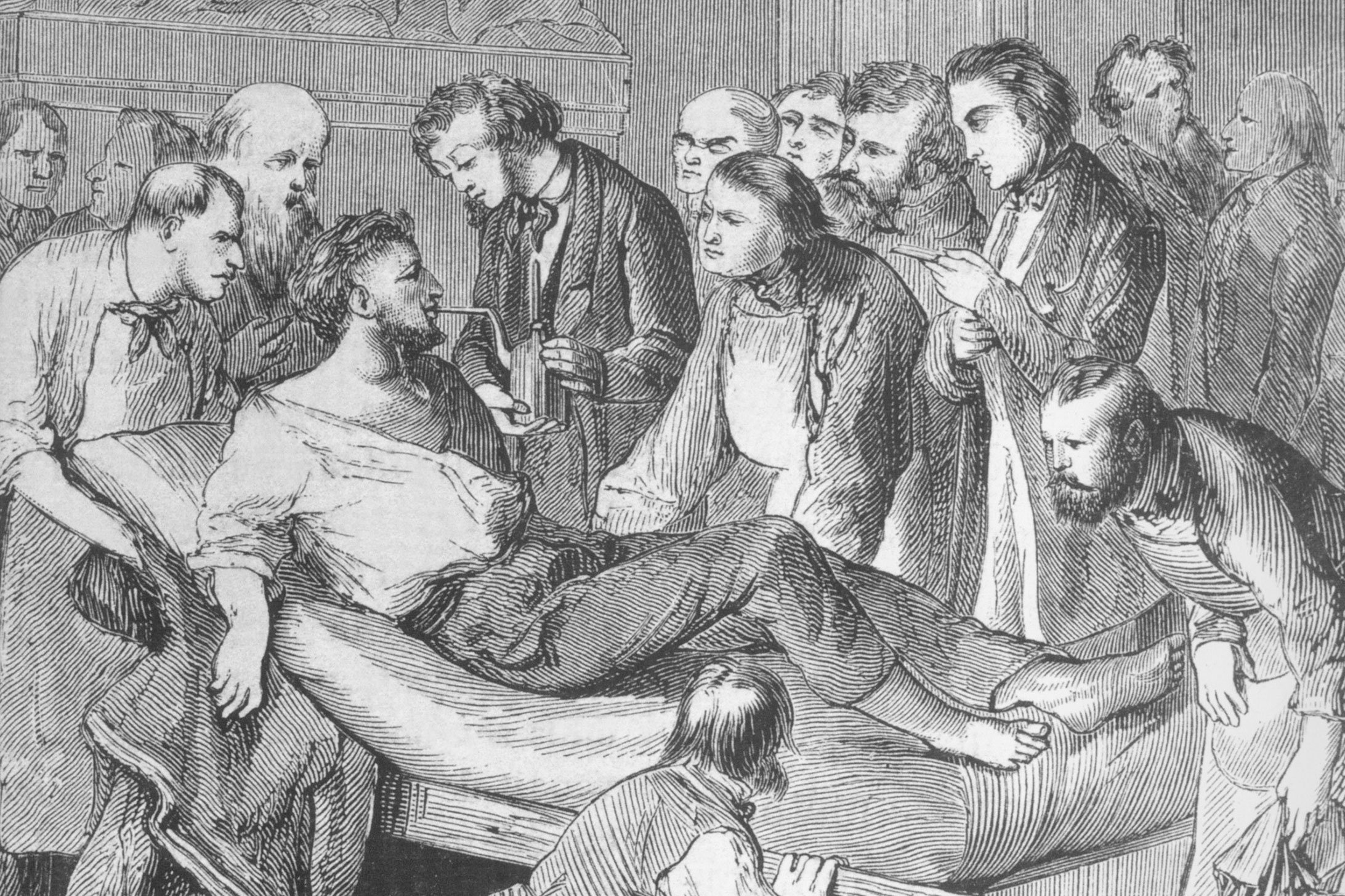 Historische Illustration der ersten Verabreichung von Ether an einen Patienten am 16. Oktober 1846.